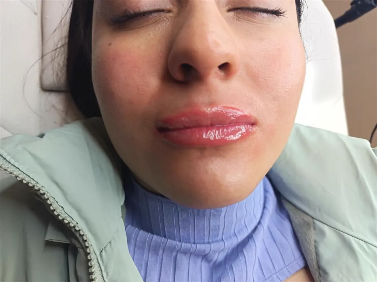 Caso real 2: efecto gloss en labios