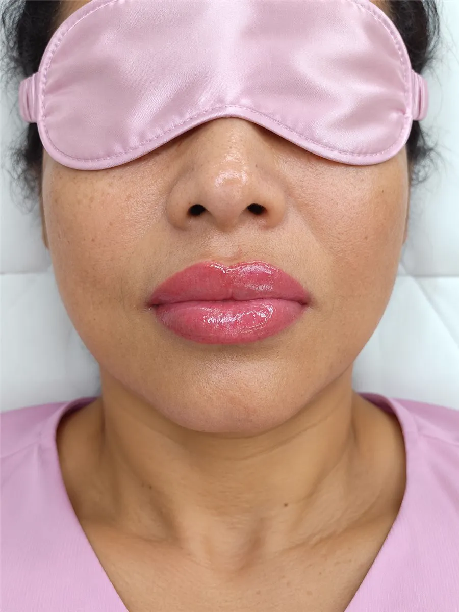 Caso real 5: resultado luminoso de lip blush
